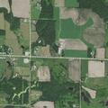 65-year-old man with LVAD short of breath in Baldwin