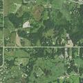 Person with swollen legs near 200th Street North, Forest Lake