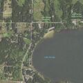 Person with abdominal pain at Oaks of Lake George
