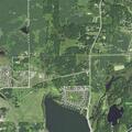 75-year-old man with pain near Lindstrom