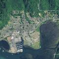 Twelve-month-old girl with breathing trouble in Garibaldi