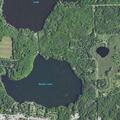 57-year-old man with neck pain in Oneida County