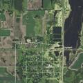 77-year-old male falls and suffers head injury