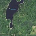 82-year-old man falls and has breathing problems