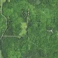 79-year-old man with abdominal pain in Erwin Township
