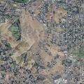 78-year-old woman falls and needs breathing assistance