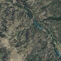 73-year-old woman with right side pain on Spruce St