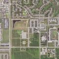 Person has numbness in legs near Moorhead