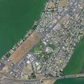 63-year-old man with weakness and swollen limbs in Moses Lake