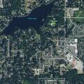 87-year-old male with hernia abdominal pain in Issaquah