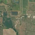 74-year-old woman with obstructed bowel in Watford City