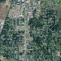 Person experiencing chest pain near Spruce Road