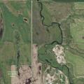 81-year-old woman with chest pain in Souris, ND