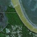 70-year-old man with abnormal breathing at remote river site