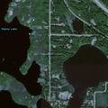 54-year-old woman with abdominal pain in Willow, Alaska