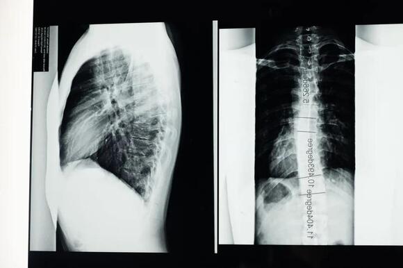 Why Some People Are Born With an Extra Rib and Never Notice - NewsBreak