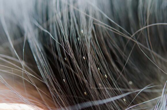 13 Living Creatures Found on the Human Body - NewsBreak