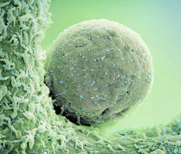 8 Times California Led the Nation in Biotech Innovation - NewsBreak
