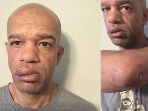 Black undercover police officer beaten up by his own colleagues awarded ...