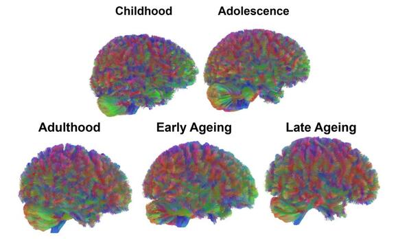 Scientists map five different and distinct stages of human brain aging ...