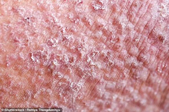 Top dermatologist reveals how to stop breaking out from using your ...