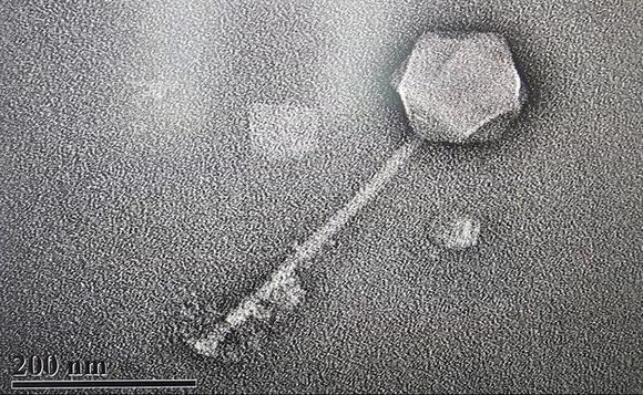 California startup says it has injected AI-designed virus into humans ...