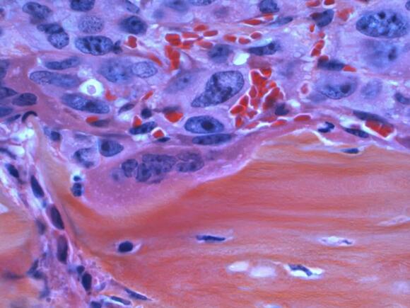 The Dust Factor: How the Body Sheds 40,000 Dead Skin Cells Every Minute ...