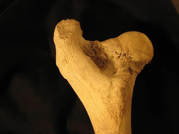 Ounce for Ounce: Why Living Human Bone Is Technically Stronger Than ...
