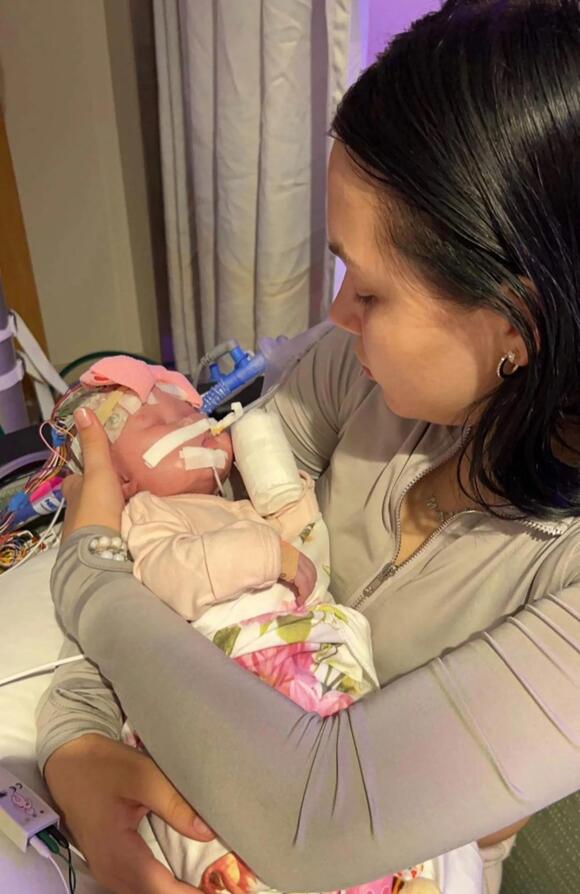 My baby was born without eyes and had half her brain removed — but she's  thriving