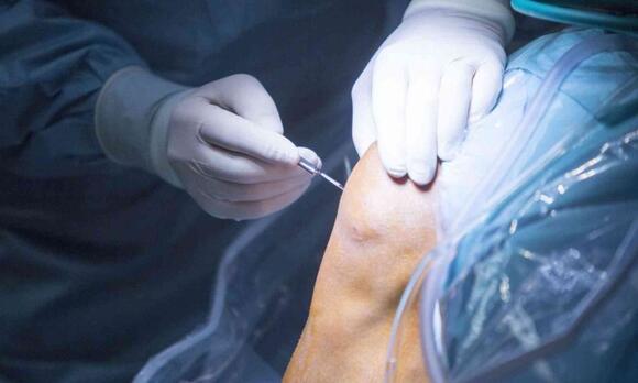 Common knee surgery may do more harm than good - NewsBreak