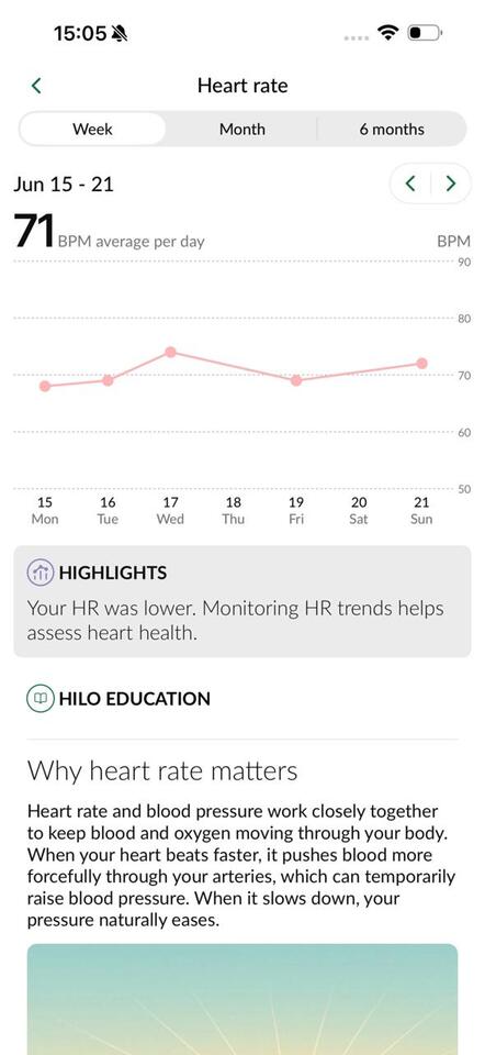Say Goodbye to Daily Cuffs: Hilo Core Brings Continuous Blood Pressure ...