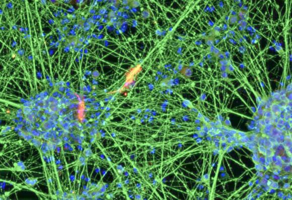 Blood Cells From an 80-Year-Old Were Reprogrammed to Show an Epigenetic ...