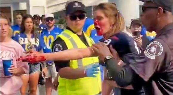 Fans Are Now Boycotting NFL Games After Horrifying Scene That Left Female  Fan Gushing Blood Went Viral [VIDEO] - NewsBreak