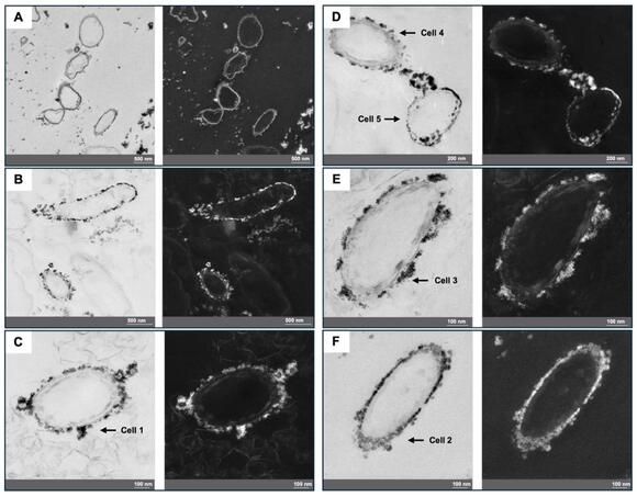 Uranium-Eating Bacteria Discovered in Radioactive Former Soviet Mine ...