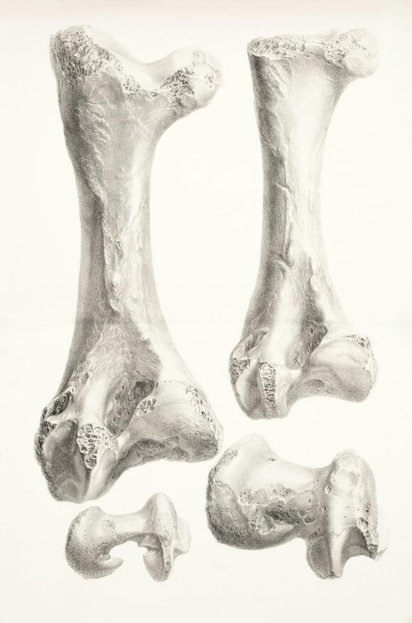 How Long Do Bones Last Before They Break Down Completely? - NewsBreak