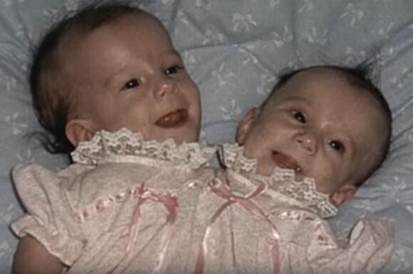 Abby And Brittany Hensel Now: Conjoined Twins Seen Out With Newborn Baby -  NewsBreak
