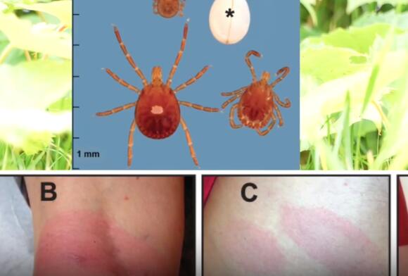 Tick activity is on the rise this year; here's how hikers can protect ...