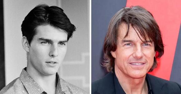 Tom Cruise's Plastic Surgery 'Clues' Broken Down — See the Astonishing Before and After Snaps Following His 'Chipmunk Cheeks' Transformation - NewsBreak