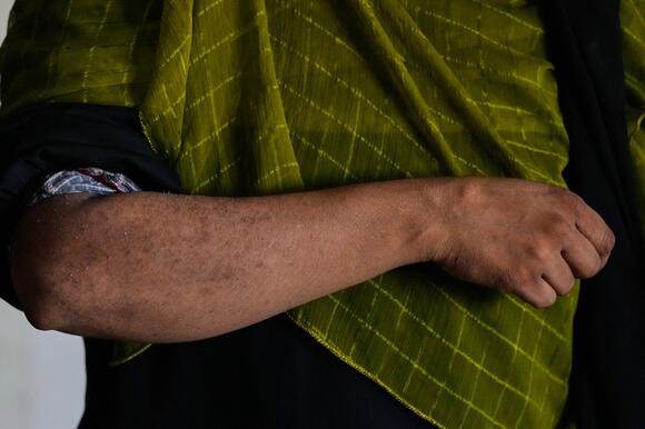 Pakistan's factory workers swelter in extreme heat as global brands ...