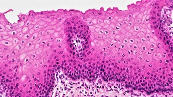 ‘The dendrimer acts like the Uber’: Researchers say a reworked tapeworm ...