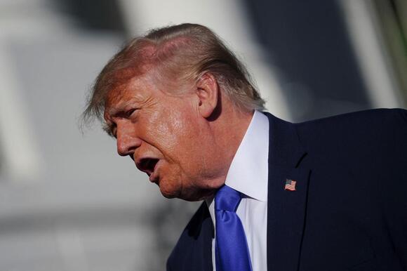 Trump, 80, Spotted With Mystery Face Bruise - NewsBreak