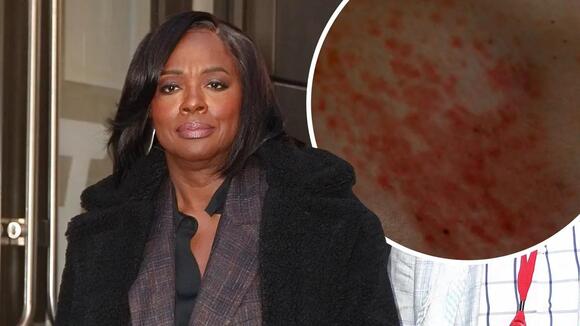 Viola Davis Addresses Health Woes While Revealing 'Debilitating' Battle ...
