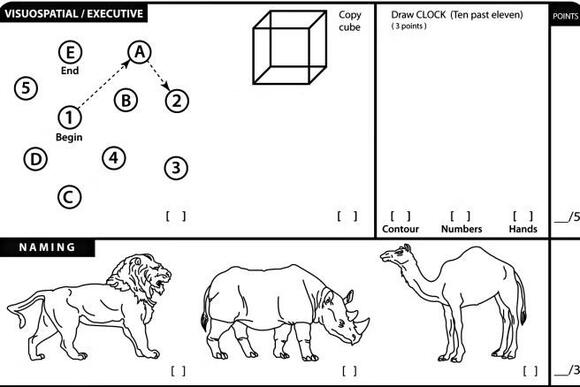 Jon Stewart trolls Trump cognitive test boasts with flashback to ...