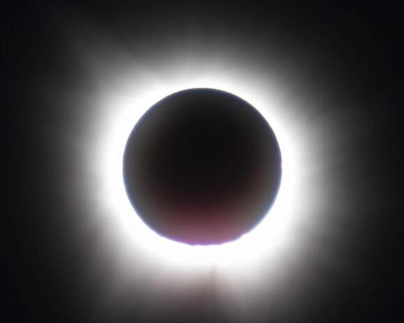 Eye injuries surge following solar eclipse: ‘Damage can be irreversible ...