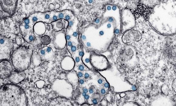 Microbe from 2 billion years ago could be the ancestor of all life on ...