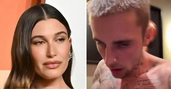 Hailey Bieber Begs Fans to Avoid This Mistake Amid Postpartum Struggles —  After Husband Justin Sets Off Warning Bells With Concerning Social Media  Posts - NewsBreak