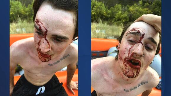 Boise County Commissioner accused of stabbing minor following jet ski ...