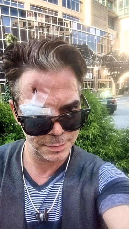 GoFundMe for actor blinded in attack over Covid mask tops $15,000 ...