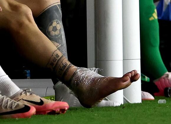 Lionel Messi left in tears at Copa America final after horror ankle ...