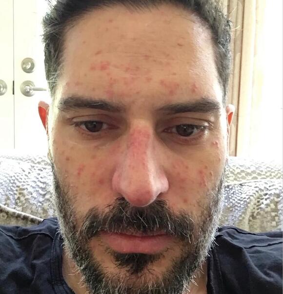 ‘Magic Mike’ Star Shares Graphic Photos From Secret Health Battle ...